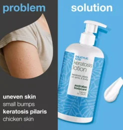 Australian Bodycare Salicylic Acid Keratosis Lotion 500 ml