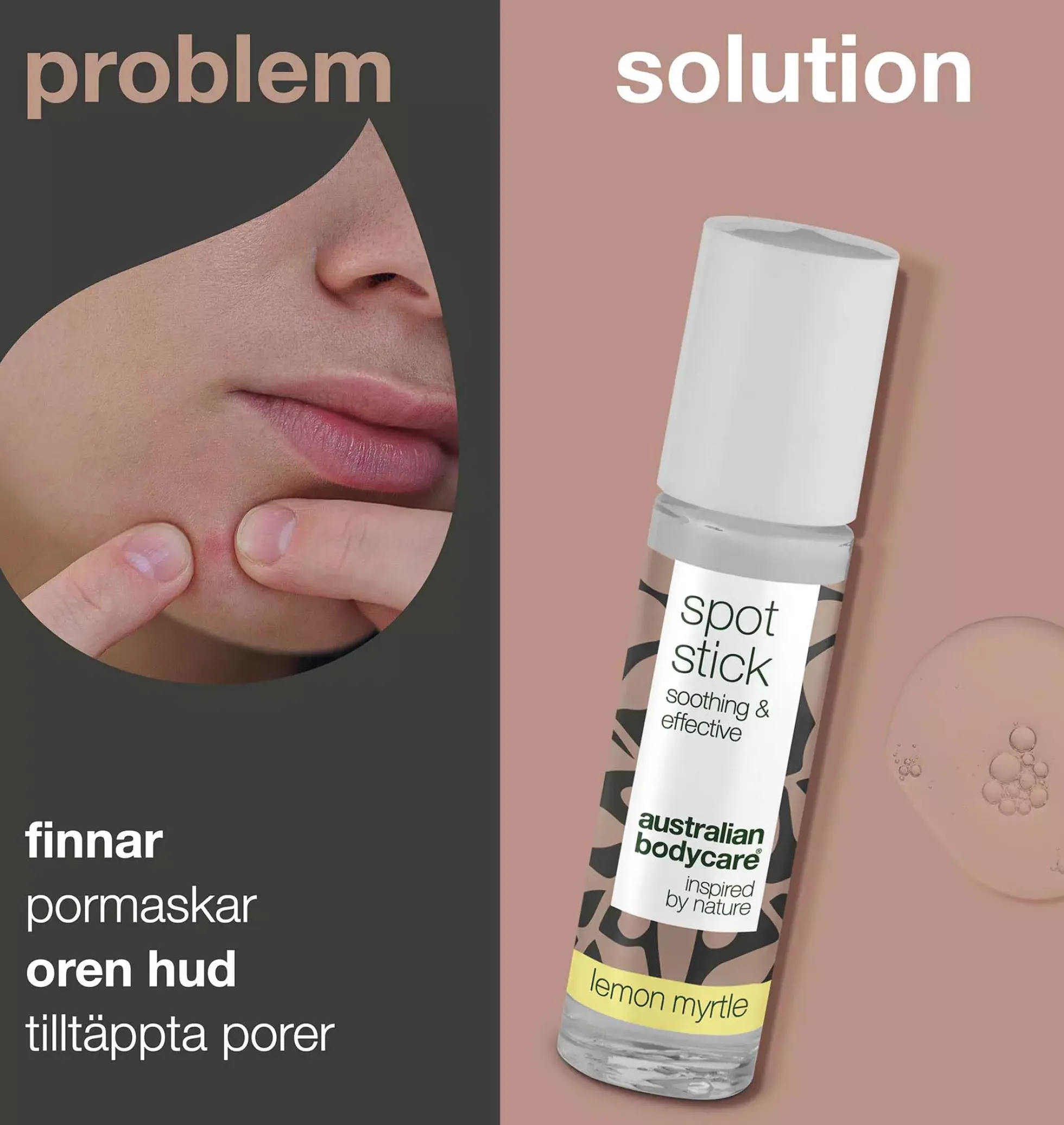 Australian Bodycare Spot Stick for pimples & blackheads 9 ml