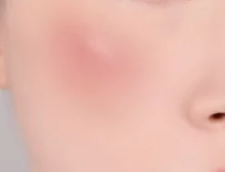 Banila Co Romantic Blush Lip & Cheek 13 Cream Coral