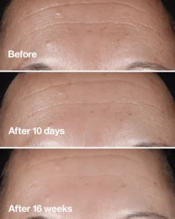 CliniqueSmart Clinical Repair Clinical Repair Wrinkle Correcting Serum 30 ml