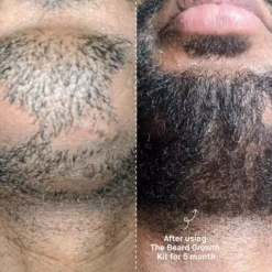 Copenhagen GroomingBeard The Beard Growth Kit