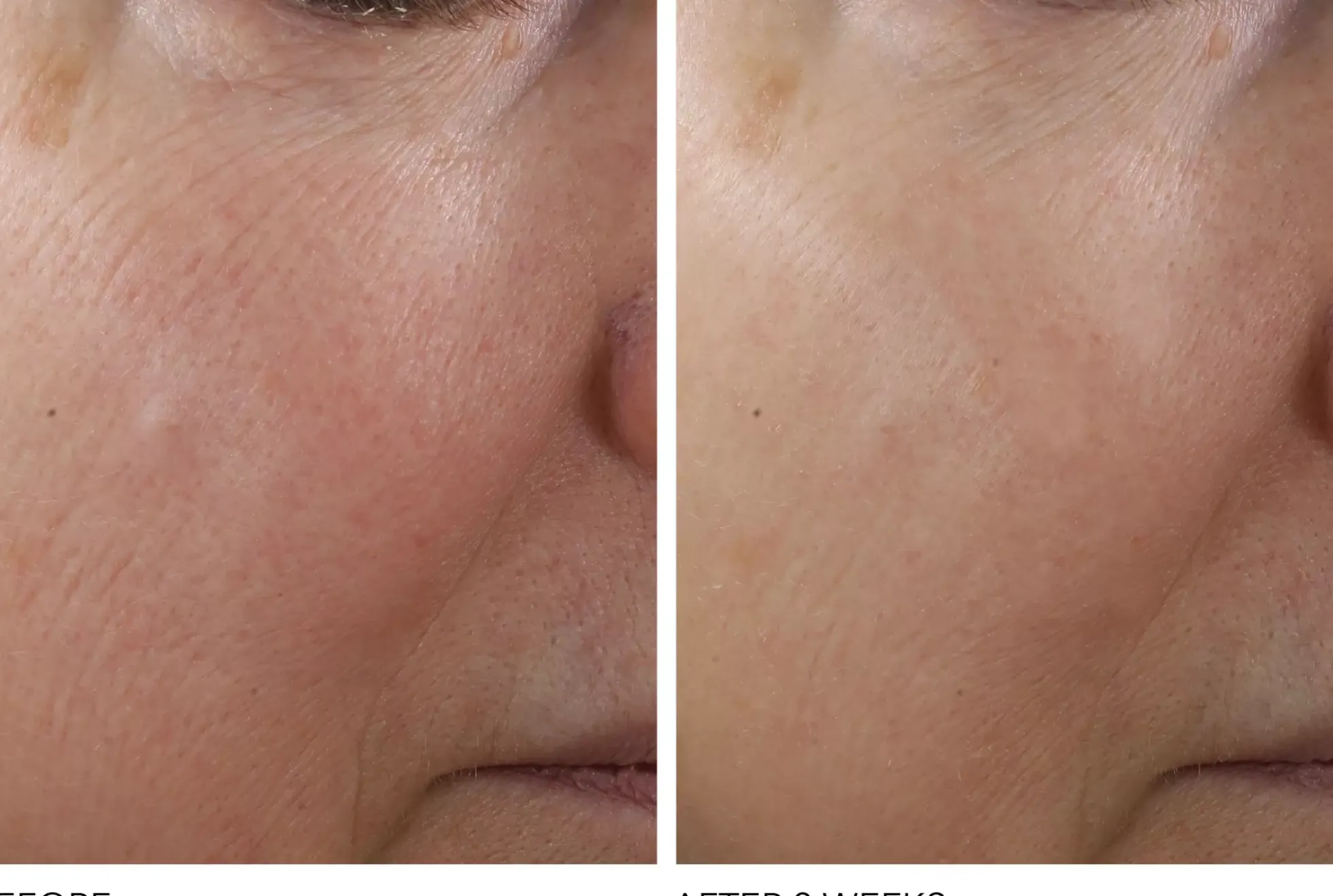 Dr Dennis Gross Advanced Retinol + Ferulic Texture Renewal Serum 30 ml