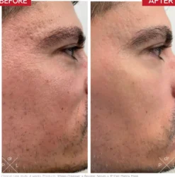 Dr. Levy MicroSkin Roller 72 g