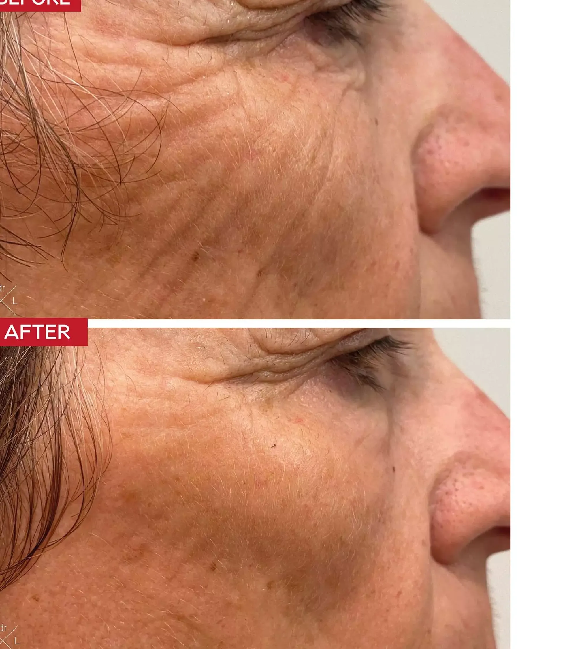 Dr. Levy The Contour Pro