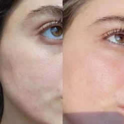 Eco By Sonya Serum of Clear 30 ml
