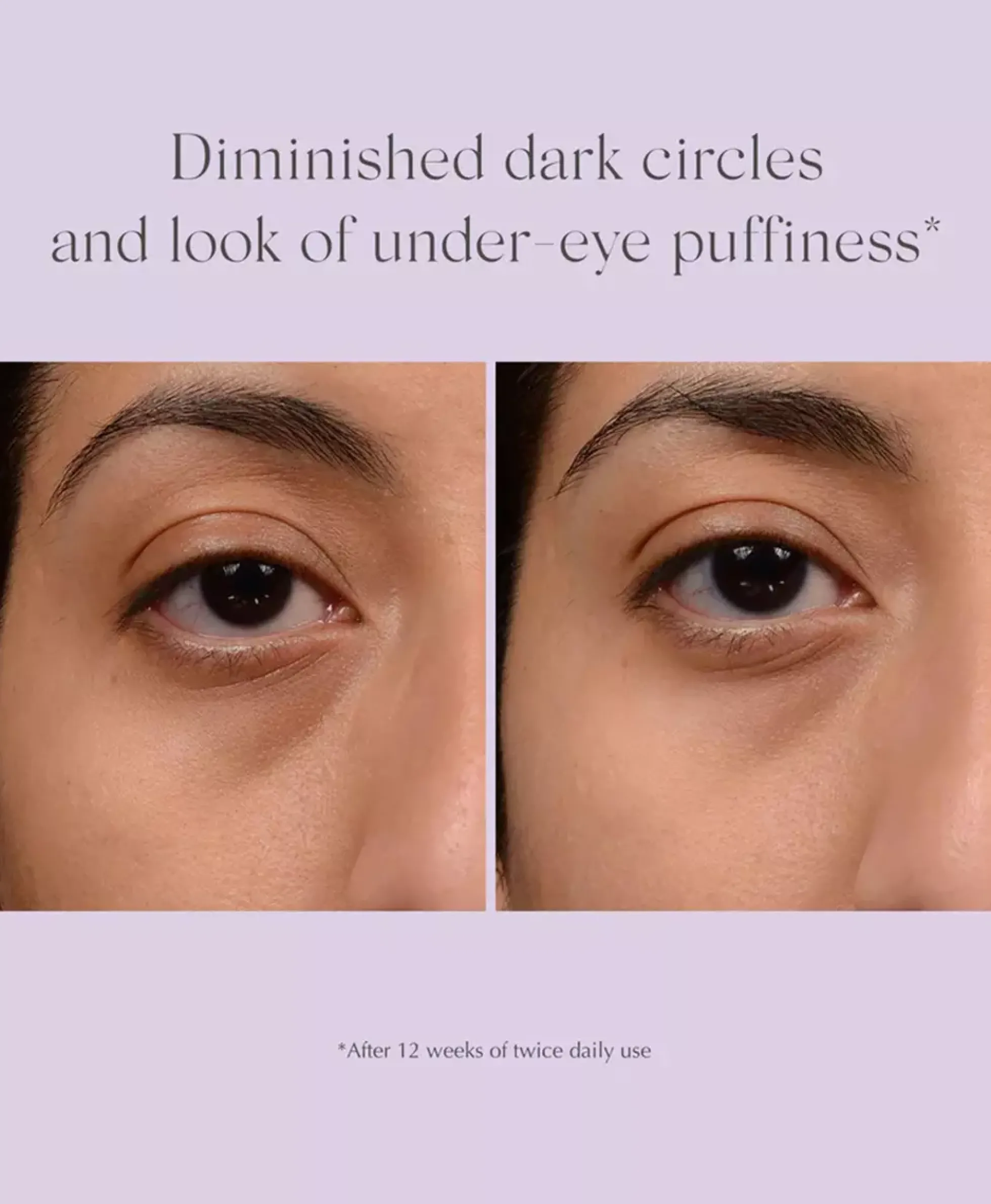 Exuviance Bright Eyes Dark Circle Corrector 15 ml