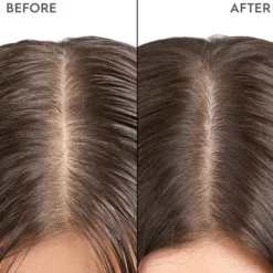 KerasilkSPECIALISTS Exfoliating Scalp & Hair Treatment 200 ml