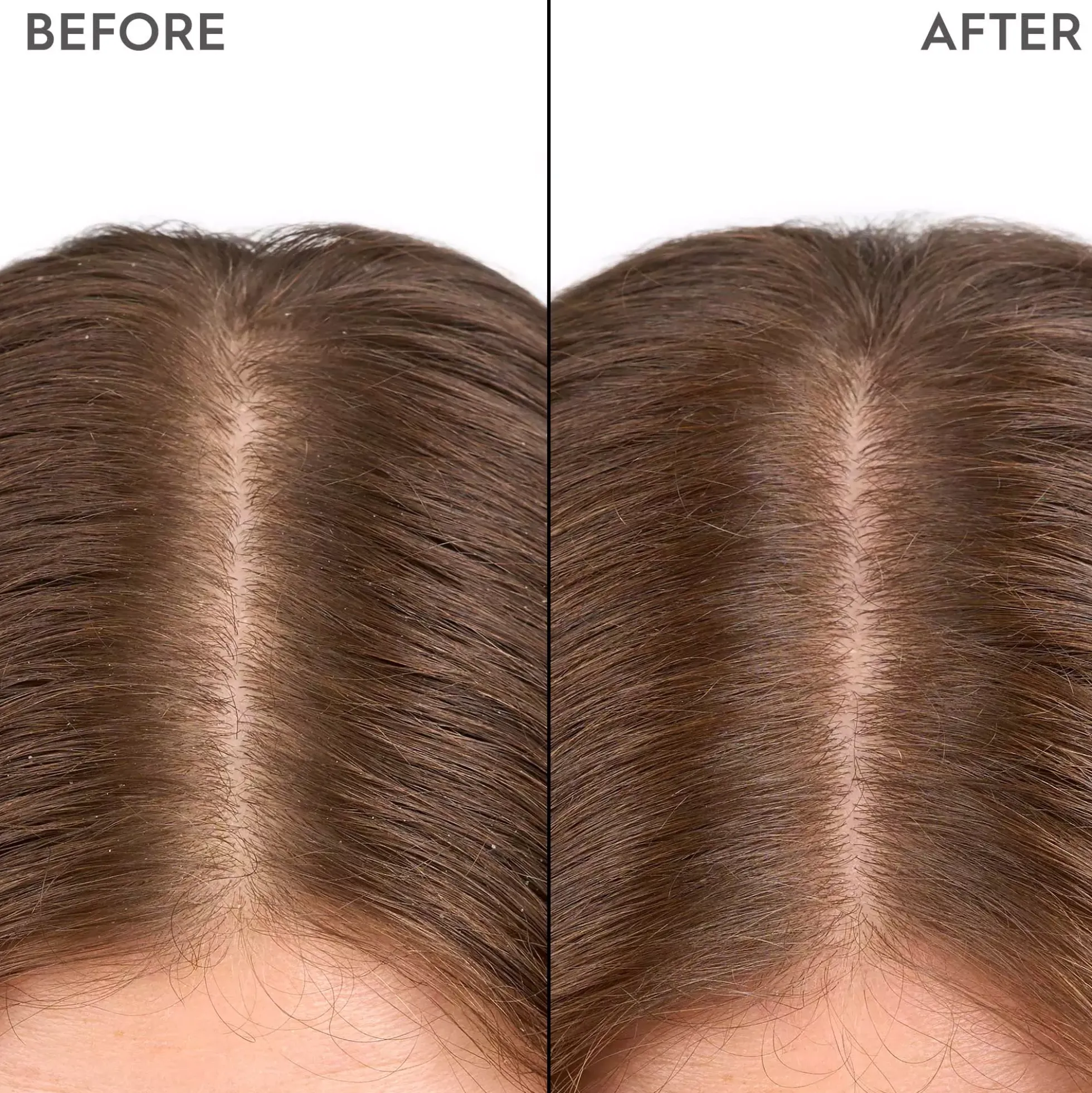 KerasilkSPECIALISTS Moisturizing Scalp Drops 100 ml