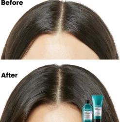 L'Oréal ProfessionnelScalp Advanced Anti-Discomfort Treatment 300 ml