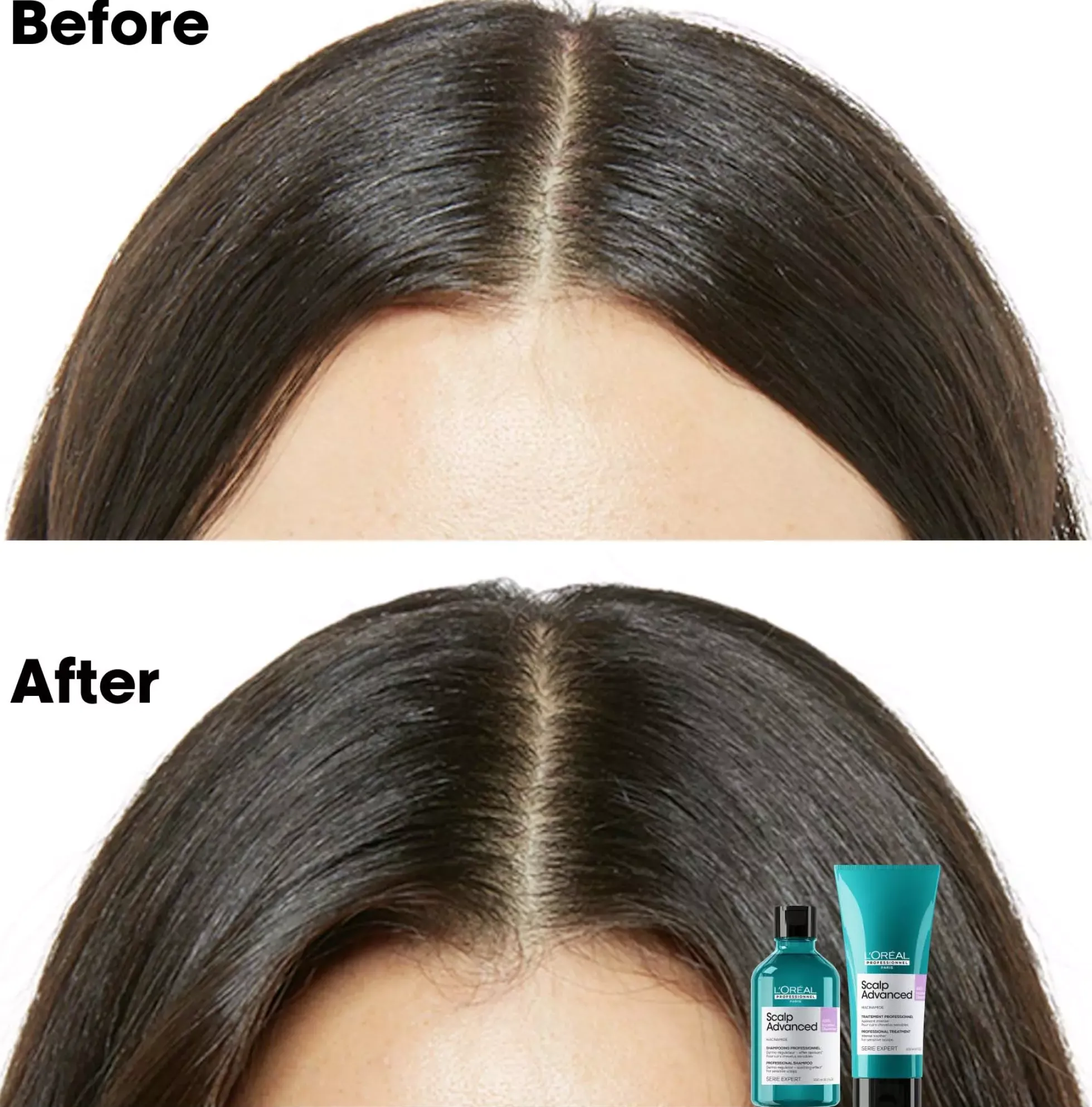 L'Oréal ProfessionnelScalp Advanced Anti-Discomfort Treatment 300 ml