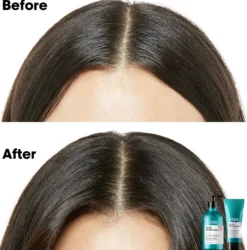 L'Oréal ProfessionnelScalp Advanced Serie Expert Professional Treatment For Sensitive Scalp 200 ml