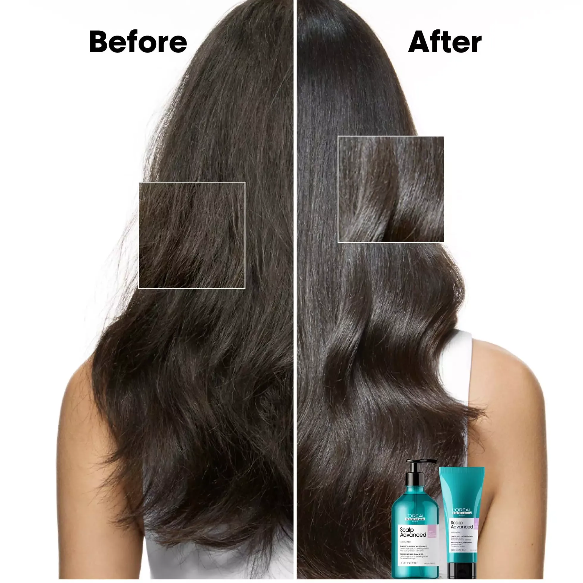 L'Oréal ProfessionnelScalp Advanced Serie Expert Professional Treatment For Sensitive Scalp 200 ml