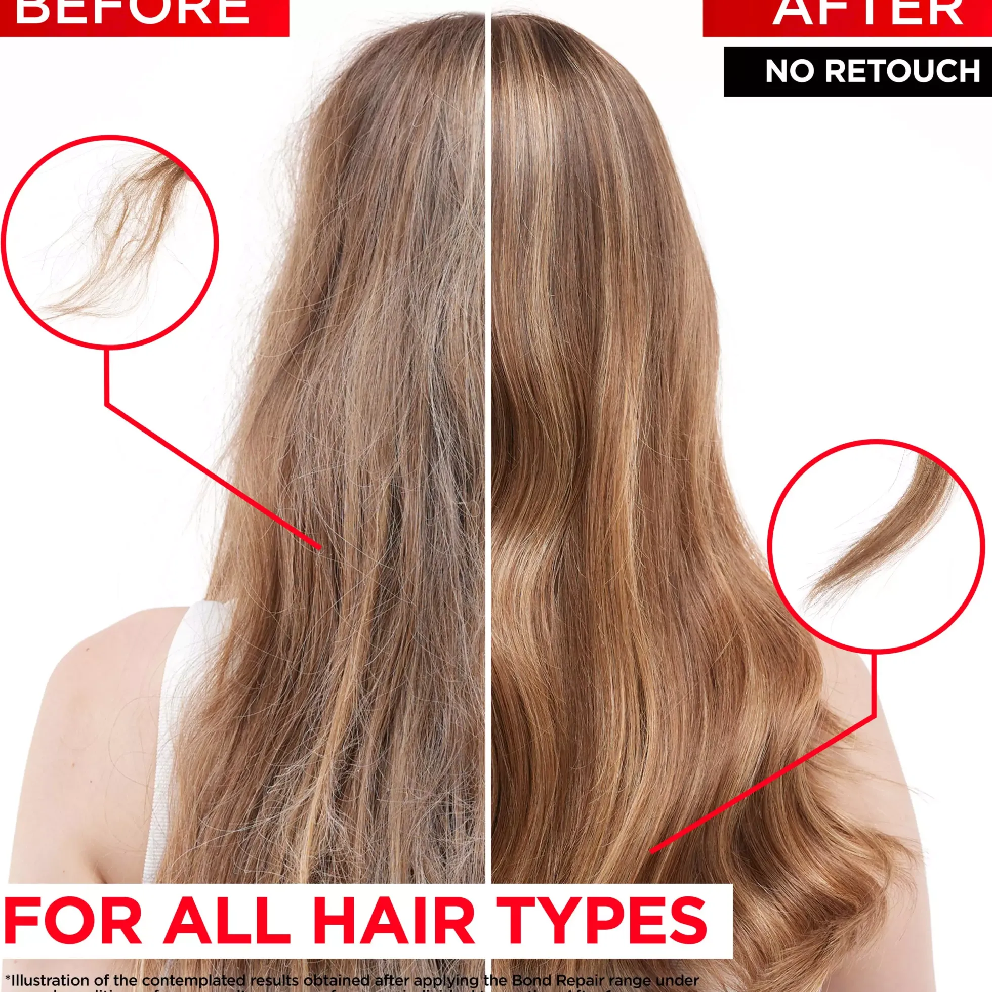 Loreal ParisElvital Bundle Shampoo 200 ml & Conditioner 150 ml & Rescue Pre-Shampoo 200 ml