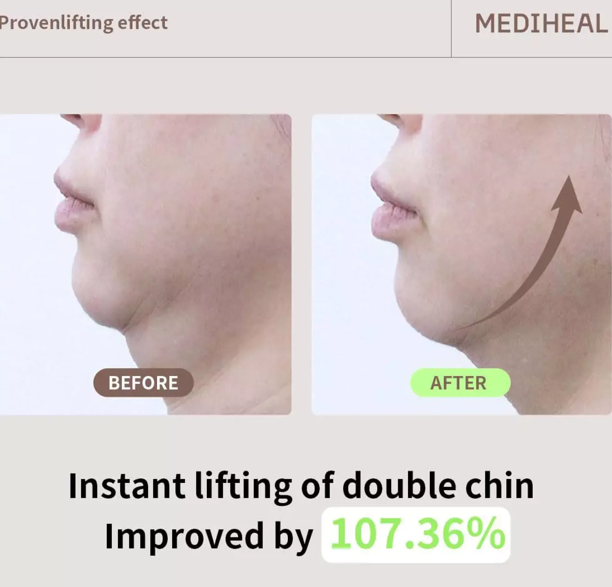 Mediheal Retinol Collagen Cream Lifting Mask 1 st