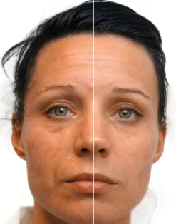 Medik8Recovery Ultimate Recovery Bio-Cellulose Mask 6-pack