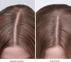 Moroccanoil Behandling för torr hårbotten - DRY 45 ml