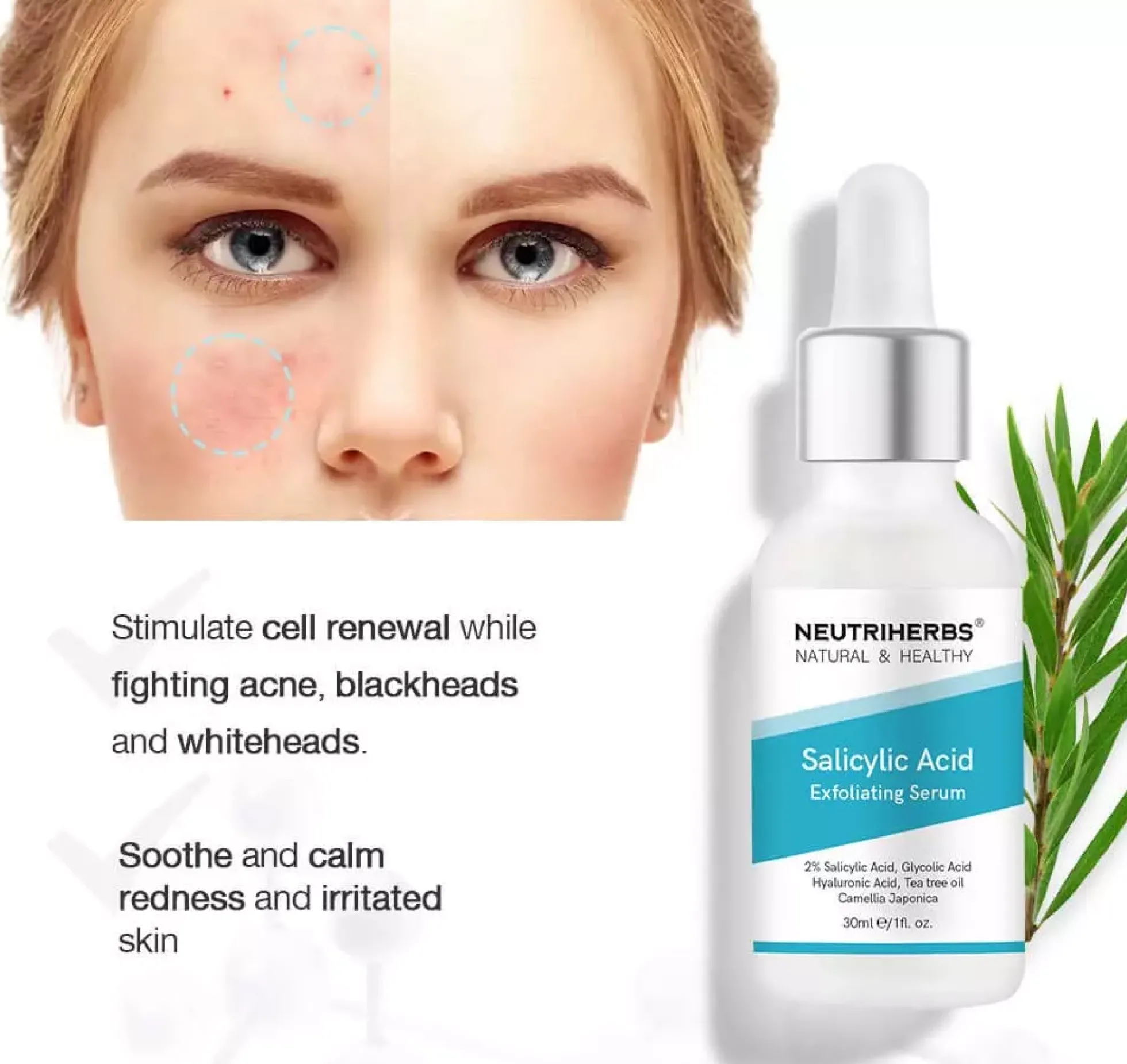 Neutriherbs Salicylic Acid Serum 30 ml