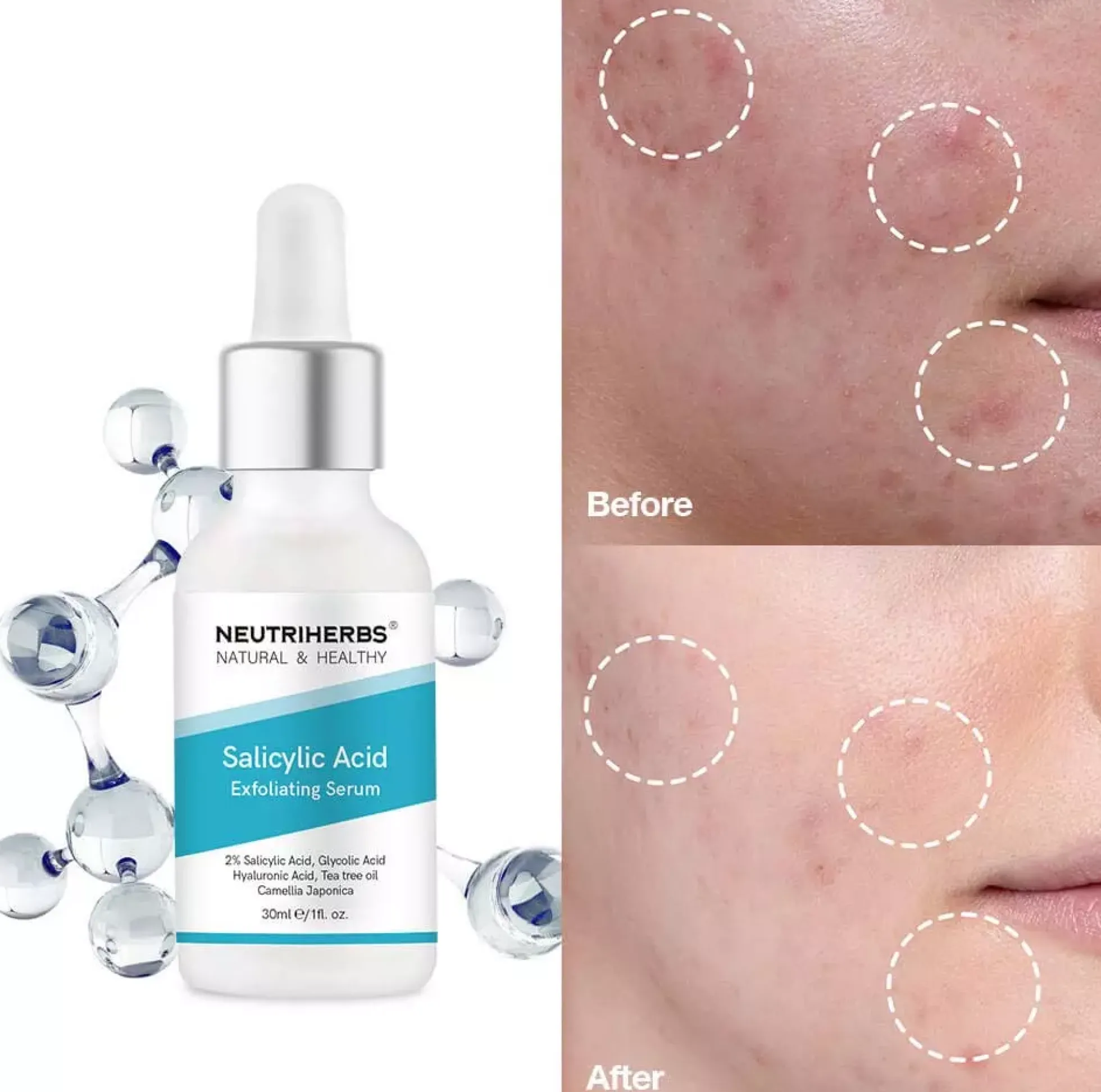 Neutriherbs Salicylic Acid Serum 30 ml