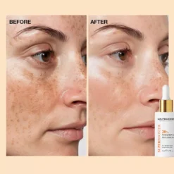 Neutriherbs Vitamin C Plus 20% Brightening Serum 30 ml