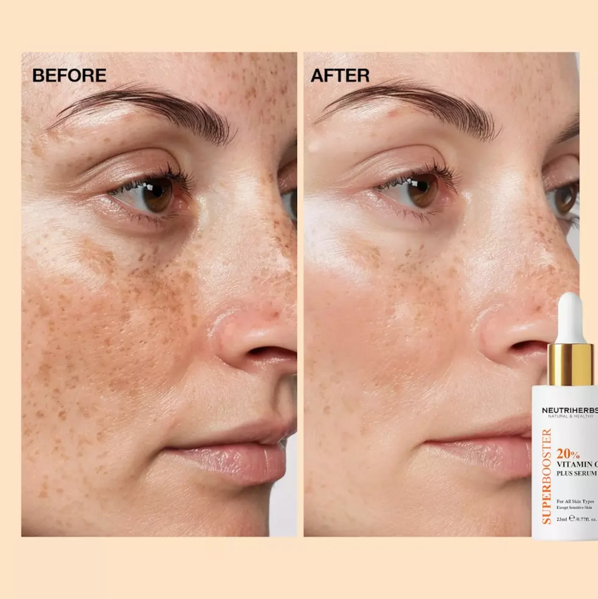 Neutriherbs Vitamin C Plus 20% Brightening Serum 30 ml