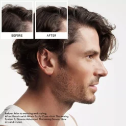 NioxinSystem 2 Loyalty Kit for Thinning Hair