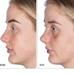NIP+FABRetinol Fix Retinol Fix Blemish Gel 15 ml