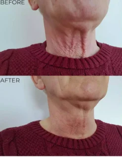 Nourish London TSL Tighten, Lift and Sculpt Neck Elixir 30 ml