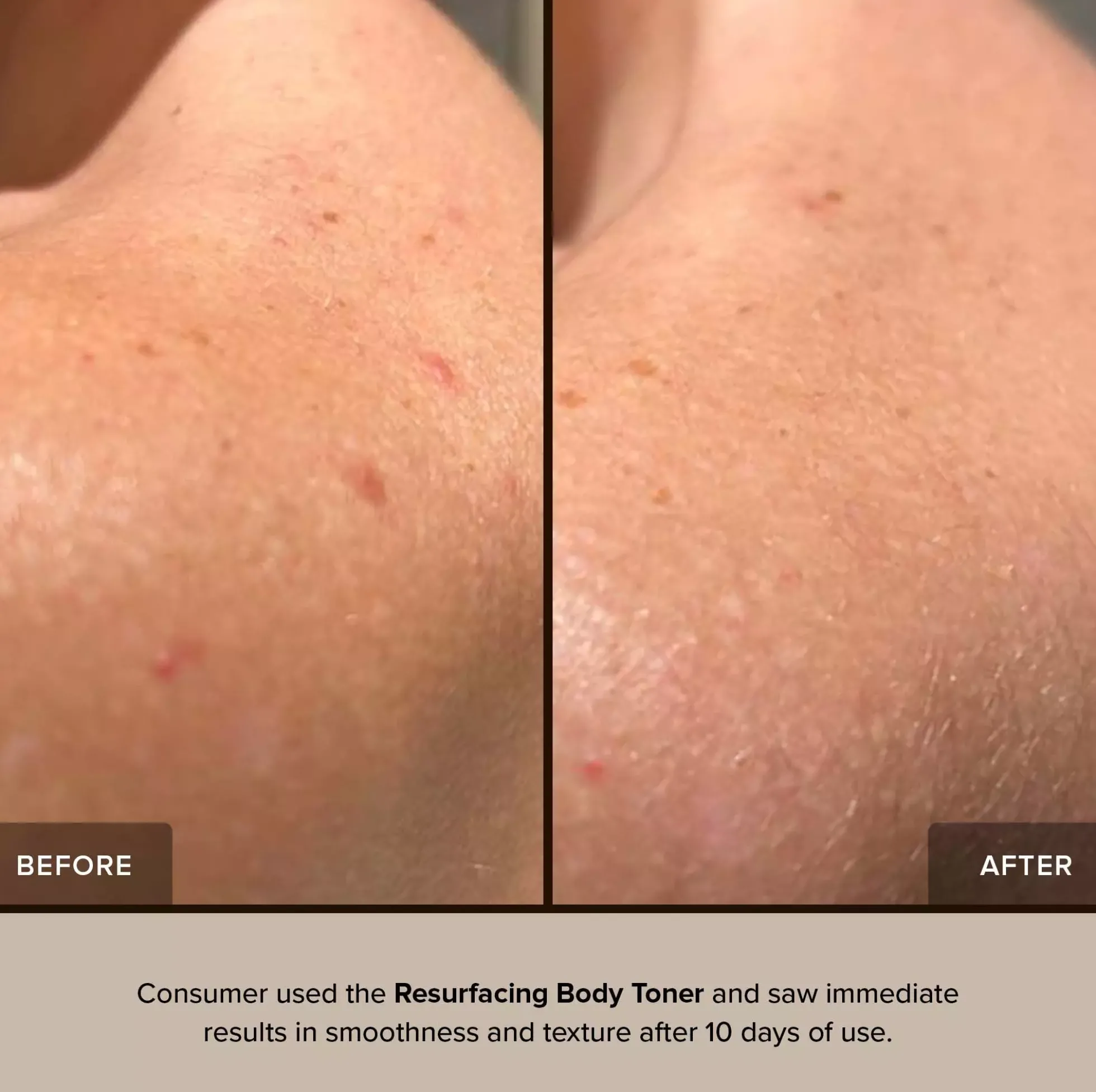 Nudestix Nudebody Resurfacing Body Toner 150 ml