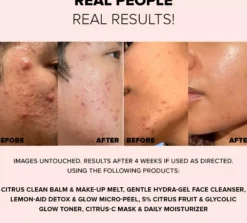 Nudestix 3-Step Citrus Skin Renewal - Makeup (Melt, Micro-peel, Moisturizer)