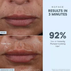 NuFACE FIX MicroWand