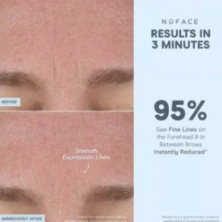 NuFACE FIX MicroWand