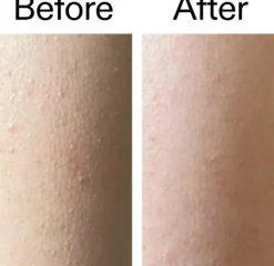 The Inkey List Glycolic Acid Exfoliating Body Stick 45 g
